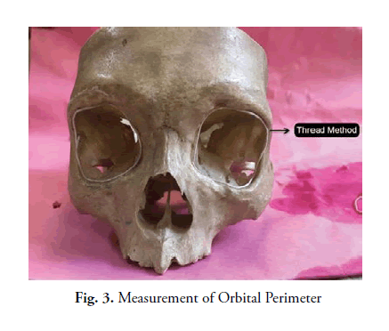 oncology-radiotherapy-orbital-Perimeter