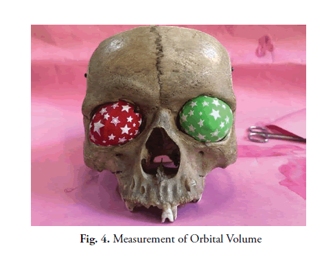 oncology-radiotherapy-orbital-Volume