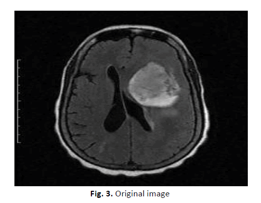 oncology-radiotherapy-original-image