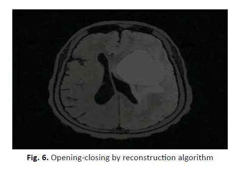 oncology-radiotherapy-reconstruction-algorithm