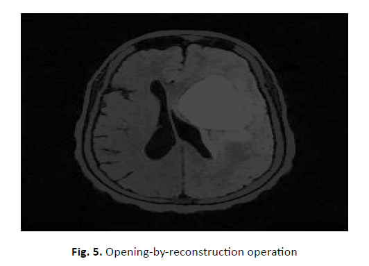 oncology-radiotherapy-reconstruction-operation