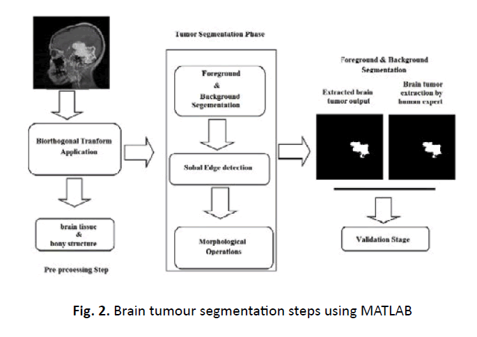 oncology-radiotherapy-tumour-segmentatio