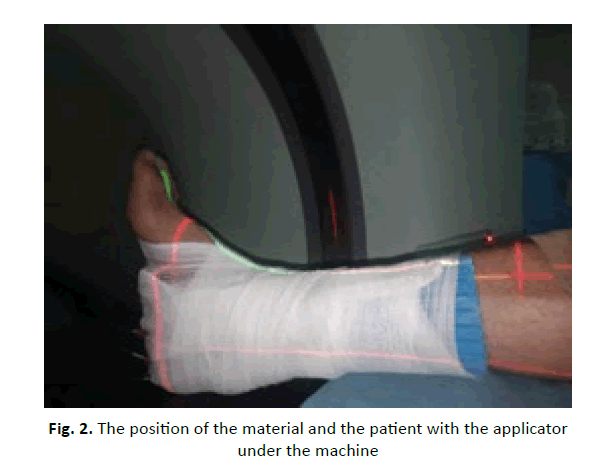 oncology-radiotherapy-under-machine
