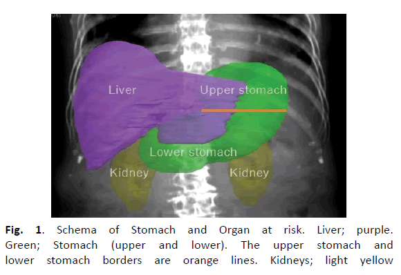 oncology-radiotherapy-upper-stomach