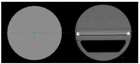 oncologyradiotherapy-CT oncologyradiotherapy-CT