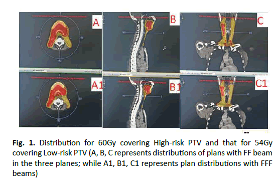 oncologyradiotherapy-distributions