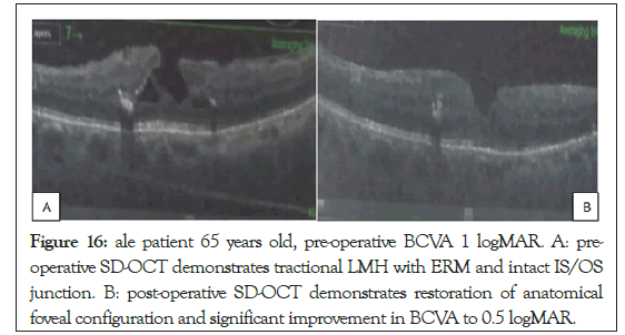 ophthalmology-configuration