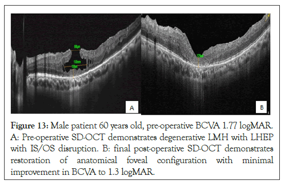 ophthalmology-disruption