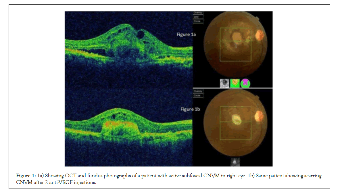 ophthalmology-fundus