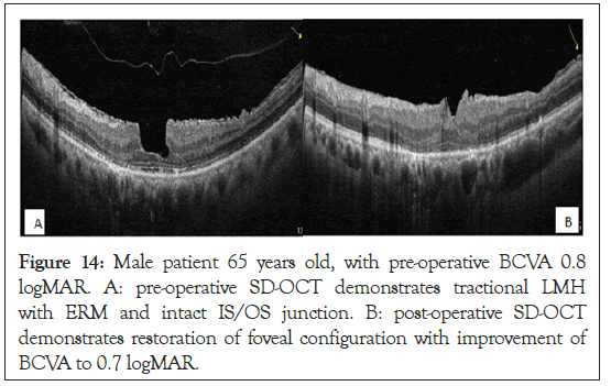 ophthalmology-improvement