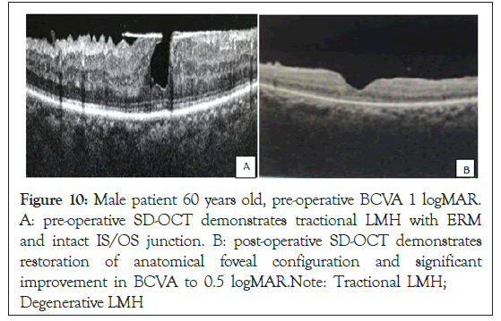 ophthalmology-intact