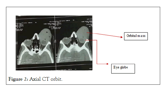 ophthalmology-orbit