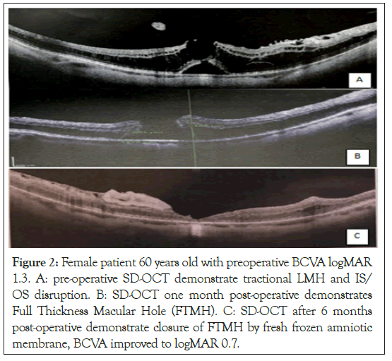 ophthalmology-preoperative