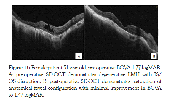 ophthalmology-restoration