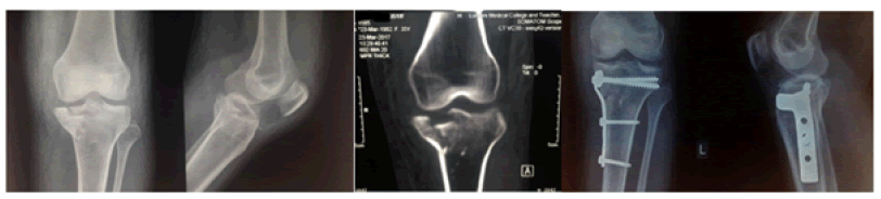 orthopedic-muscular-medial