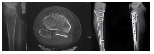 orthopedic-muscular-three
