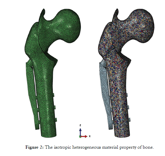 osteoporosis-physical-activity-isotropic-heterogeneous