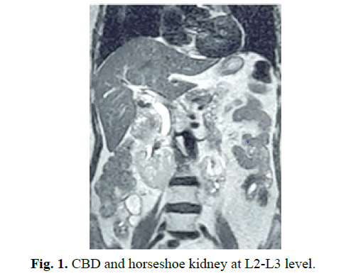 pediatric-urology-kidney