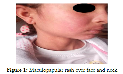 pharmacological-reports-Maculopapular