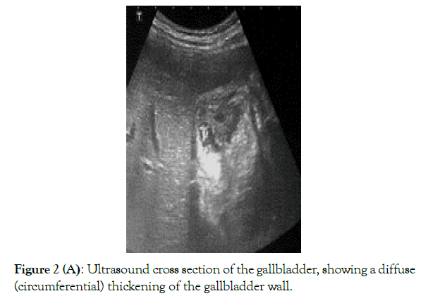 pharmacological-reports-Ultrasound