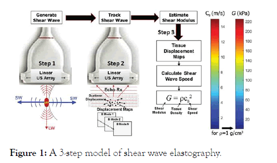 physical-medicine-elastography