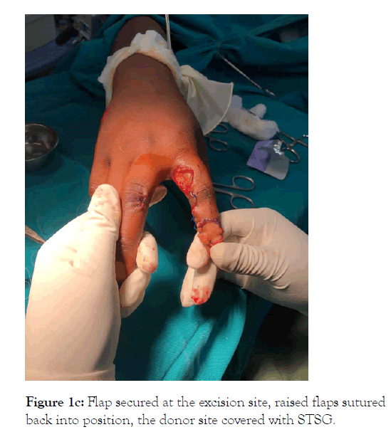 physical-medicine-excision