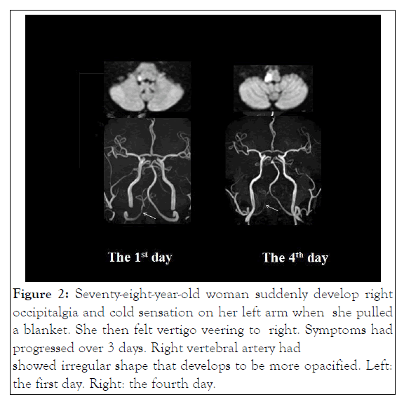 physical-medicine-occipitalgia