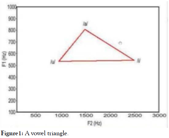 research-development-vowel-triangle-9-1-1-g001