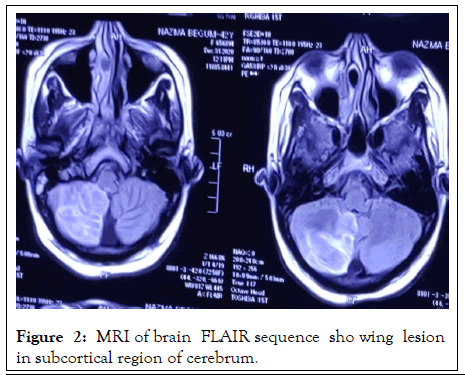 rheumatology-current-brain