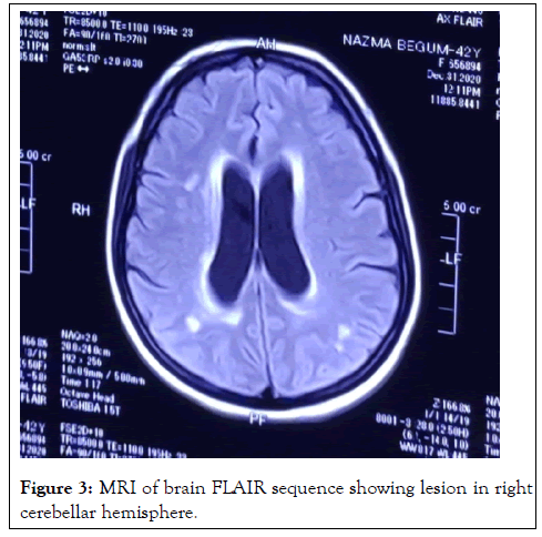 rheumatology-current-flair