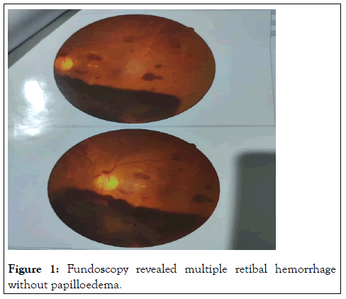 rheumatology-current-fundoscopy