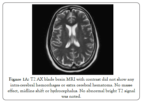 rheumatology-hemorrhages