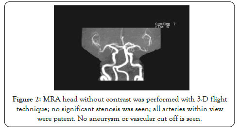 rheumatology-ventricle