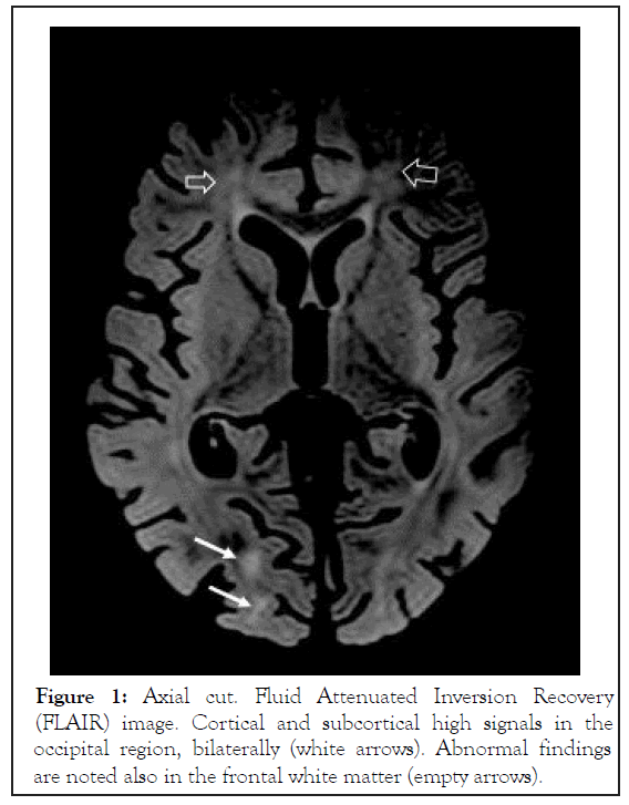 toxicology-subcortical