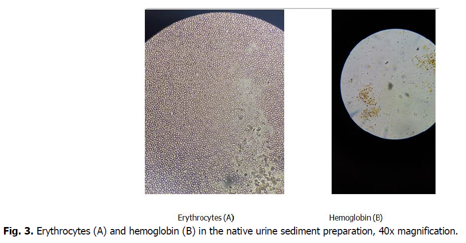 ukrainian-journal-ecology-erythrocytes