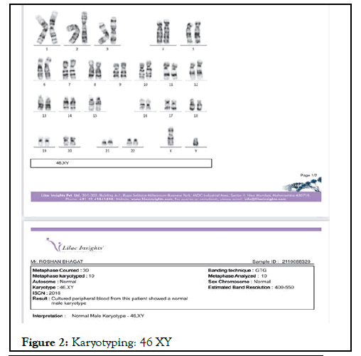 Andrology-Karyotyping