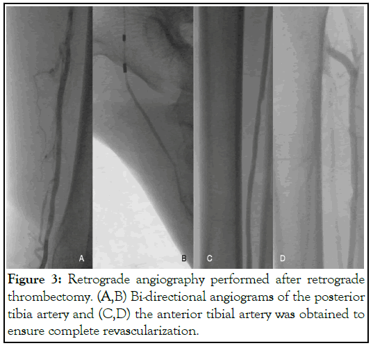 angiography