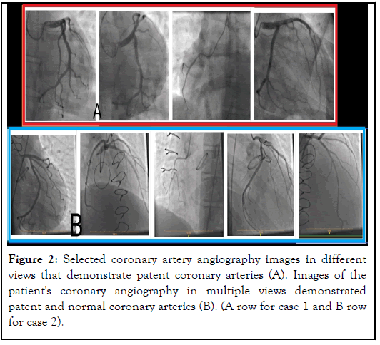 angiography