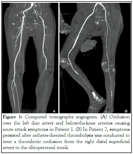 tomography