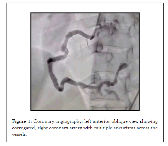 Cardiology-angiography
