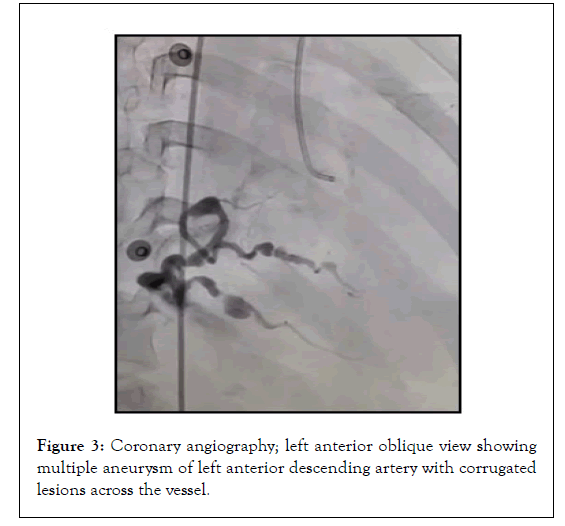 Cardiology-descending