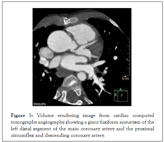 Cardiology-tomography