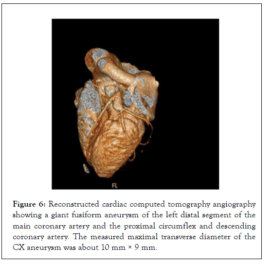 Cardiology-tomography