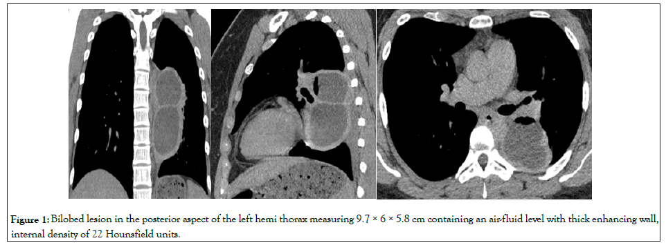 Cell-Science-thorax