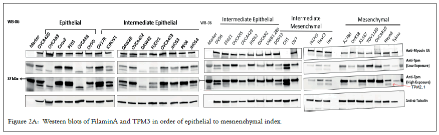 epithelial