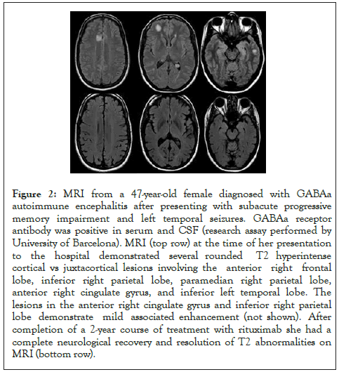 Clinical-Chemistry-seizures