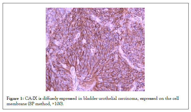 Clinical-Chemistry-urothelial