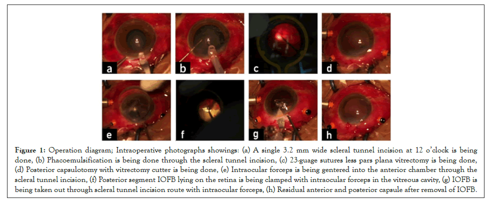 Clinical-Experimental-Intraoperative