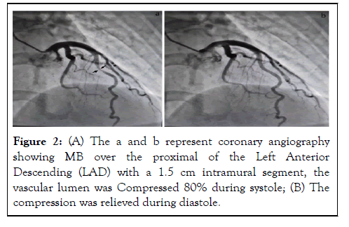 Clinical-Experimental-coronary