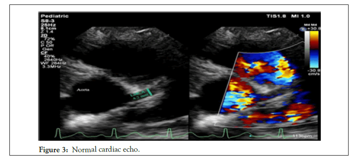 Clinical-Pediatrics-cardiac